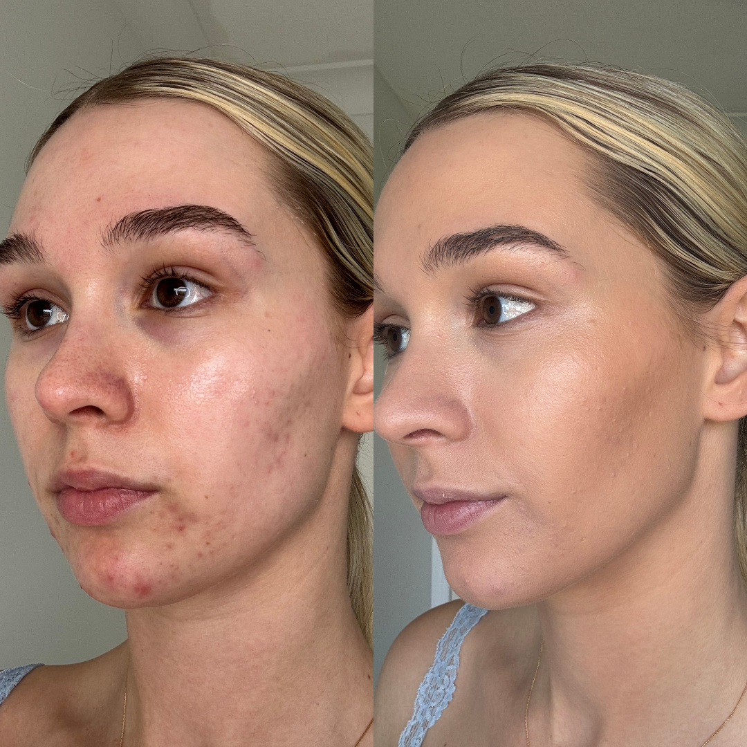 LOOSE POWDER FOUNDATION