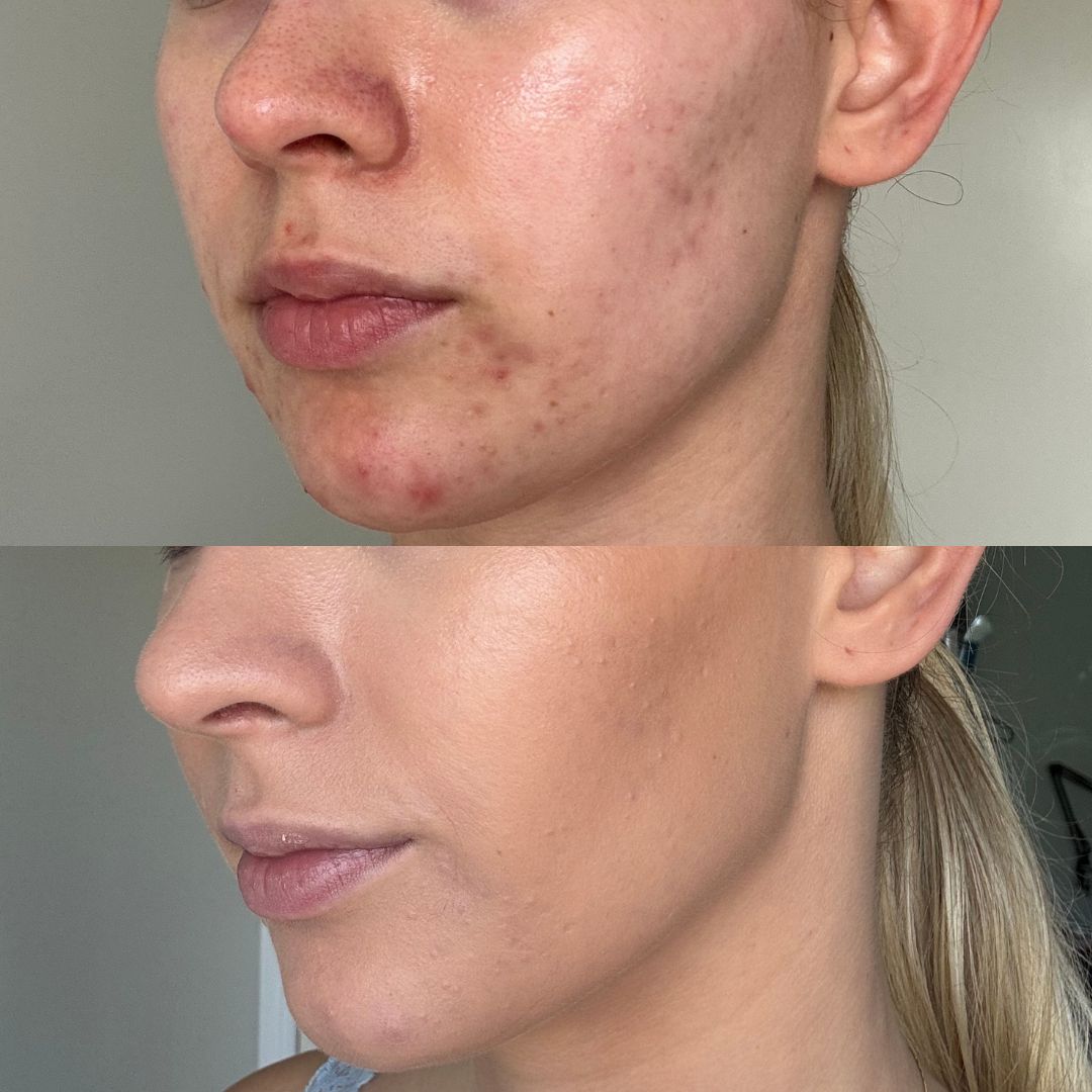 MINERAL FOUNDATION